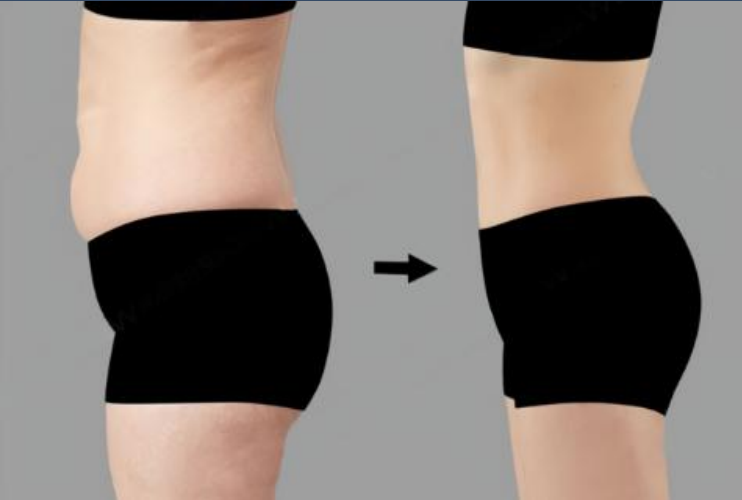 fat reduction.png fat reduction.png